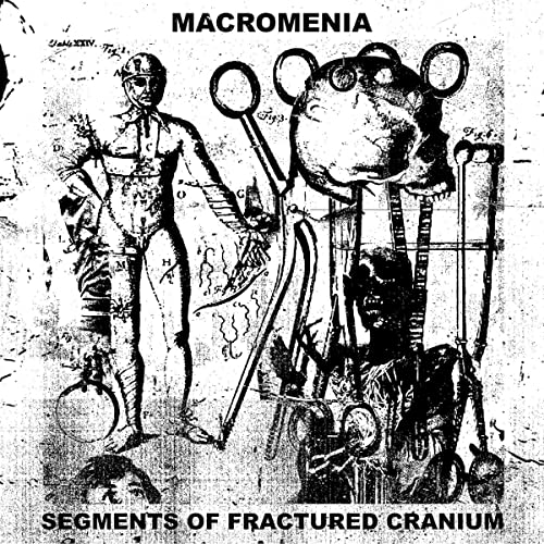 Segments Of Fractured Cranium