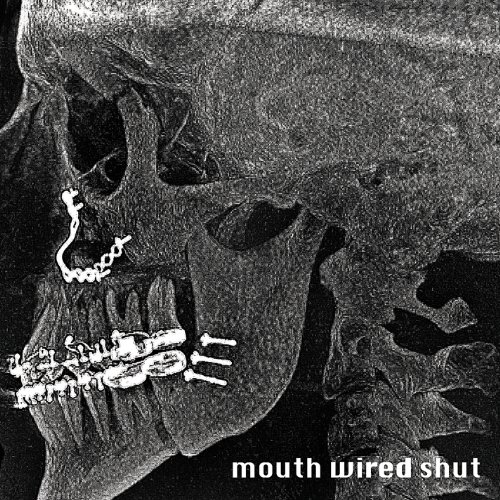 Mouth Wired Shut