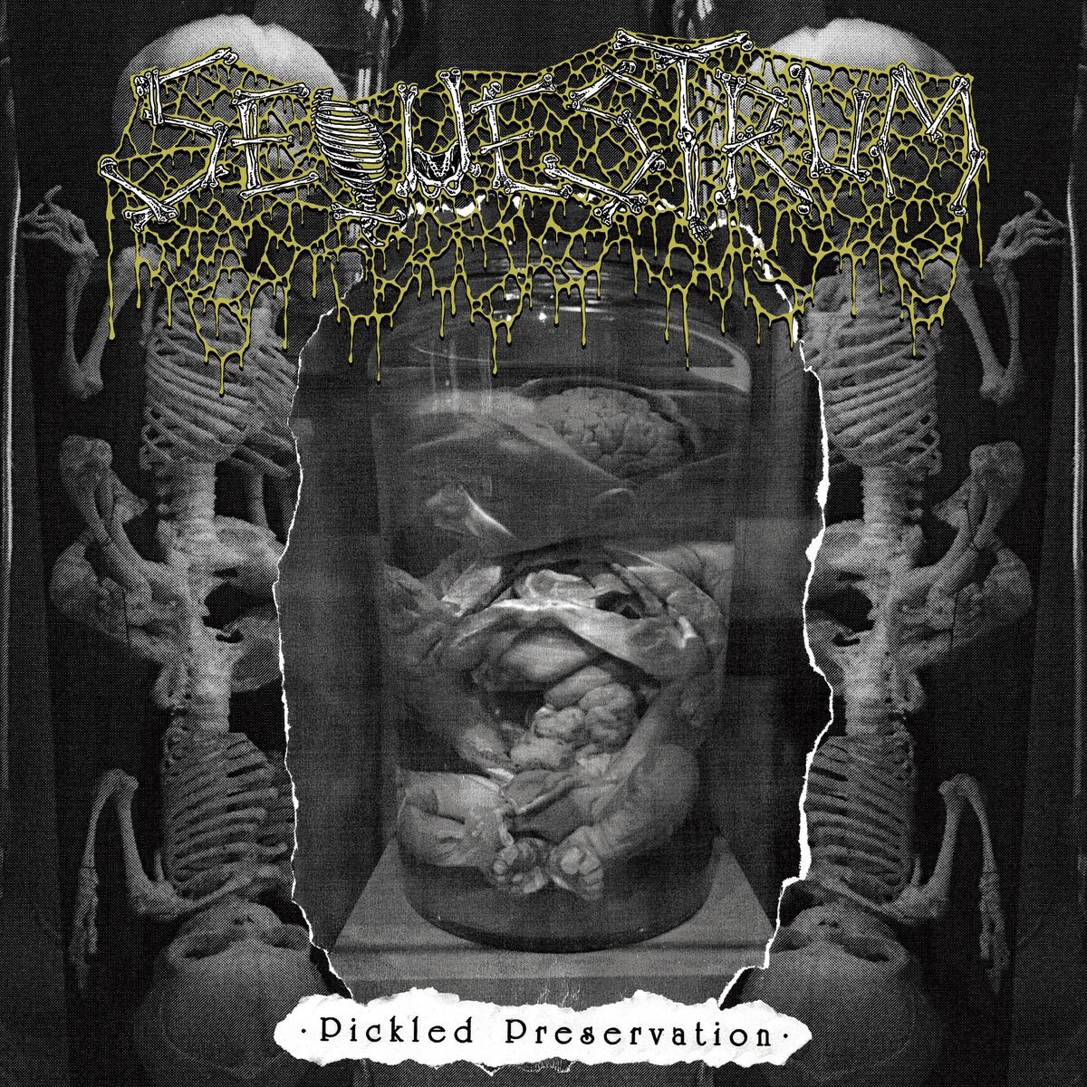Sequestrum - Pickled Preservation - Cassetta