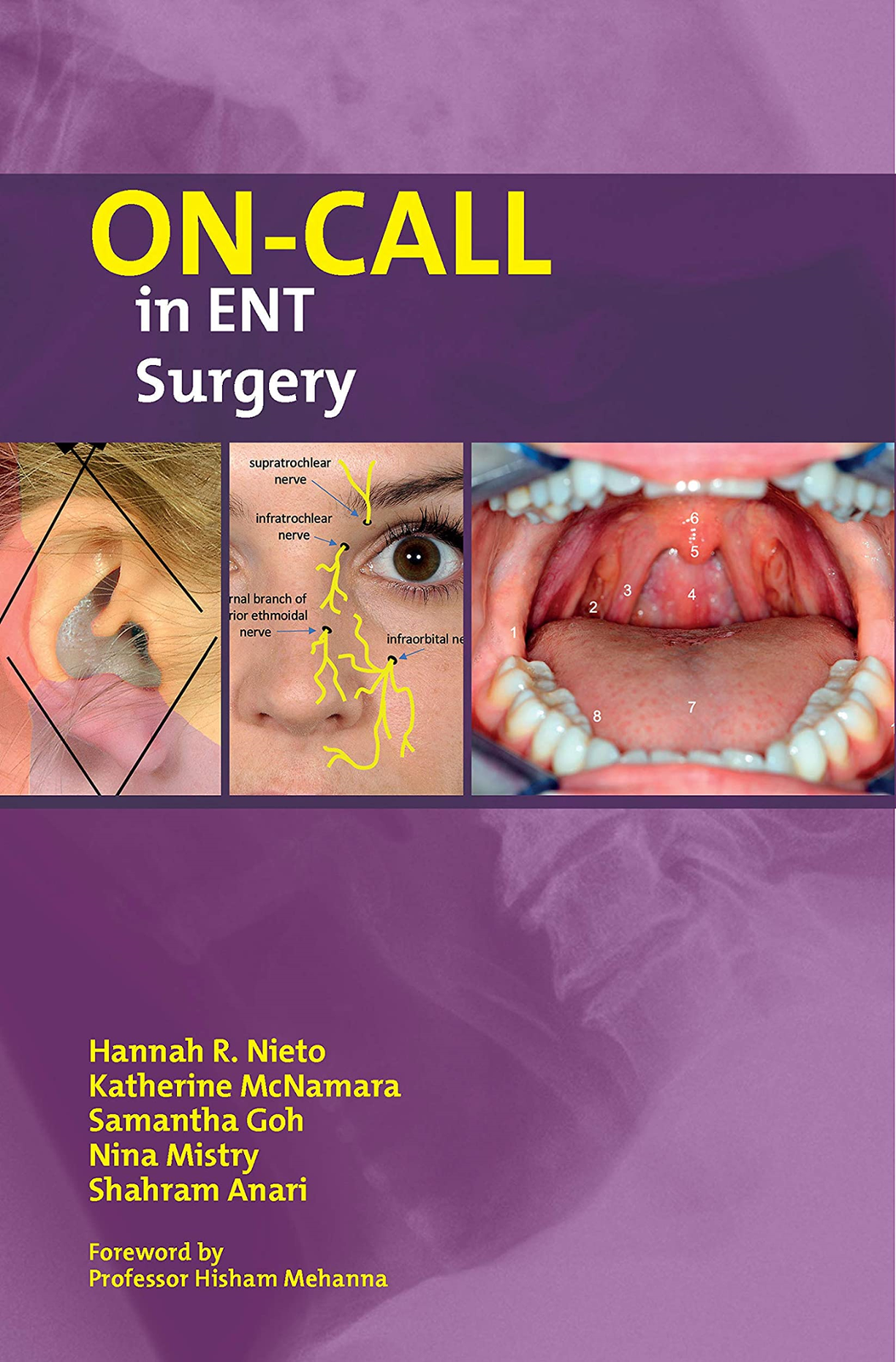 LIbri UK/US Nieto, Hannah Mcnamara, Katherine - On-Call In Ent Surgery