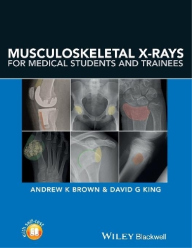Andrew Brown David Musculoskeletal X-Rays for Medical Students and  (Tascabile)