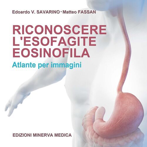 Riconoscere l’esofagite eosinofila. Atlante per immagini