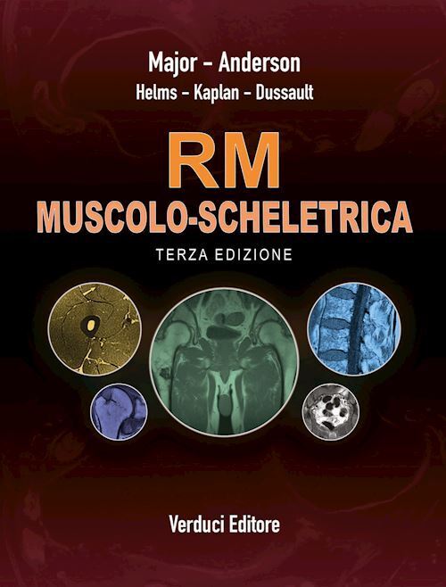 RM MUSCOLO-SCHELETRICA - RISONANZA MAGNETICA  - MAJOR NANCY, ANDERSON MARK,