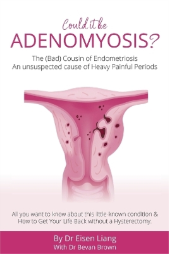 Eisen Liang Bevan Brown Adenomyosis -The Bad Cousin of Endometriosis (Tascabile)