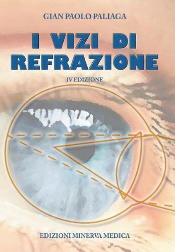 I vizi di refrazione