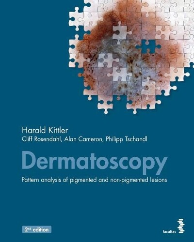 Alan Cameron Harald Kittler Cliff Rosendahl Dermatoscopy (Tascabile)