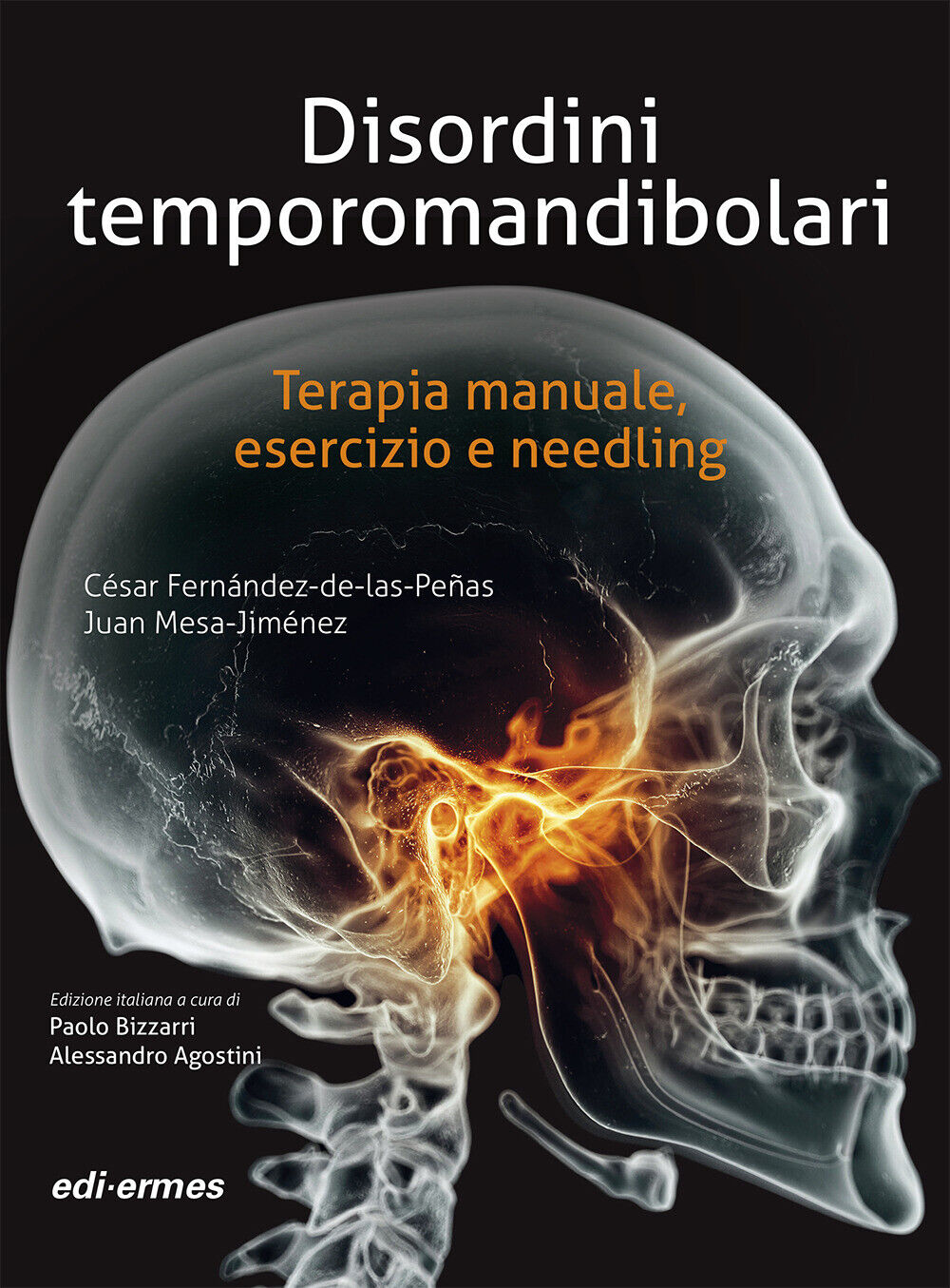 Disordini temporomandibolari. Terapia manuale, esercizio e needling. Ediz....