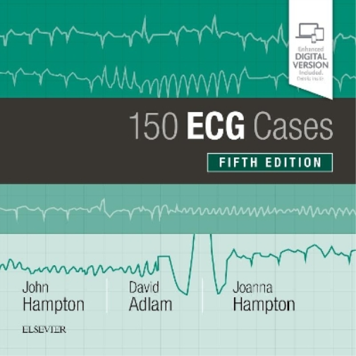 John Hampton Joanna Hampton David Adlam 150 ECG Cases (Tascabile)