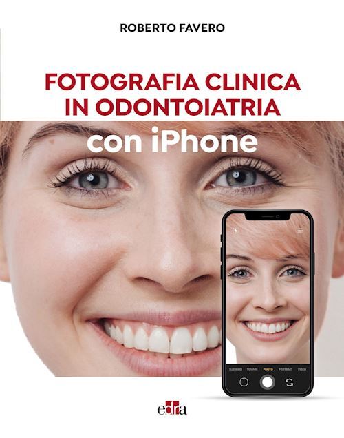 FOTOGRAFIA CLINICA IN ODONTOIATRIA CON IPHONE  - FAVERO ROBERTO - Edra