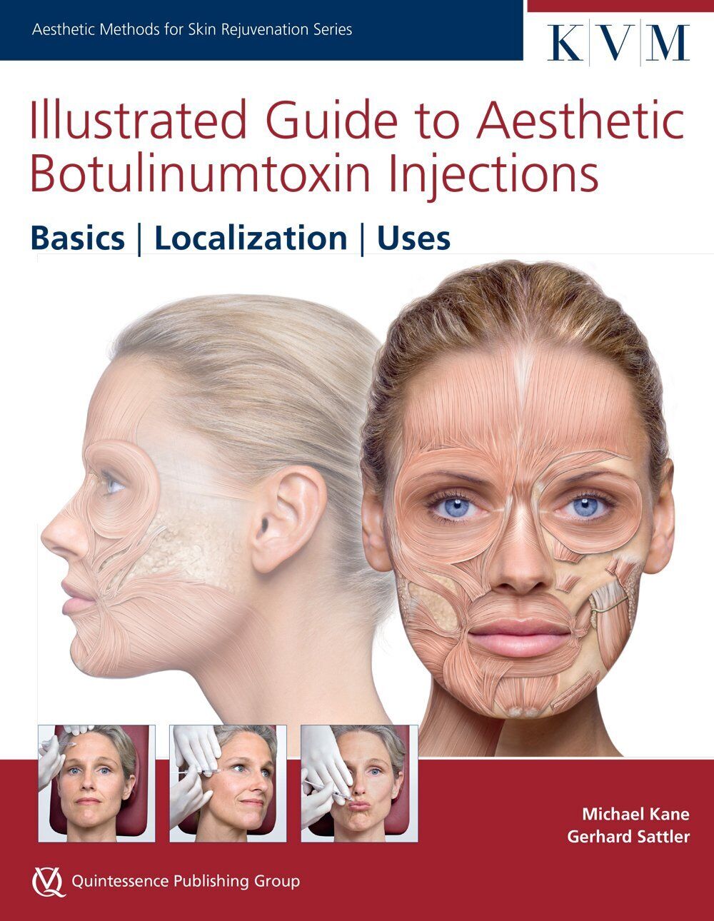 Illustrated Guide to Aesthetic Botulinum Toxin Injections - Michael Kane - 2013