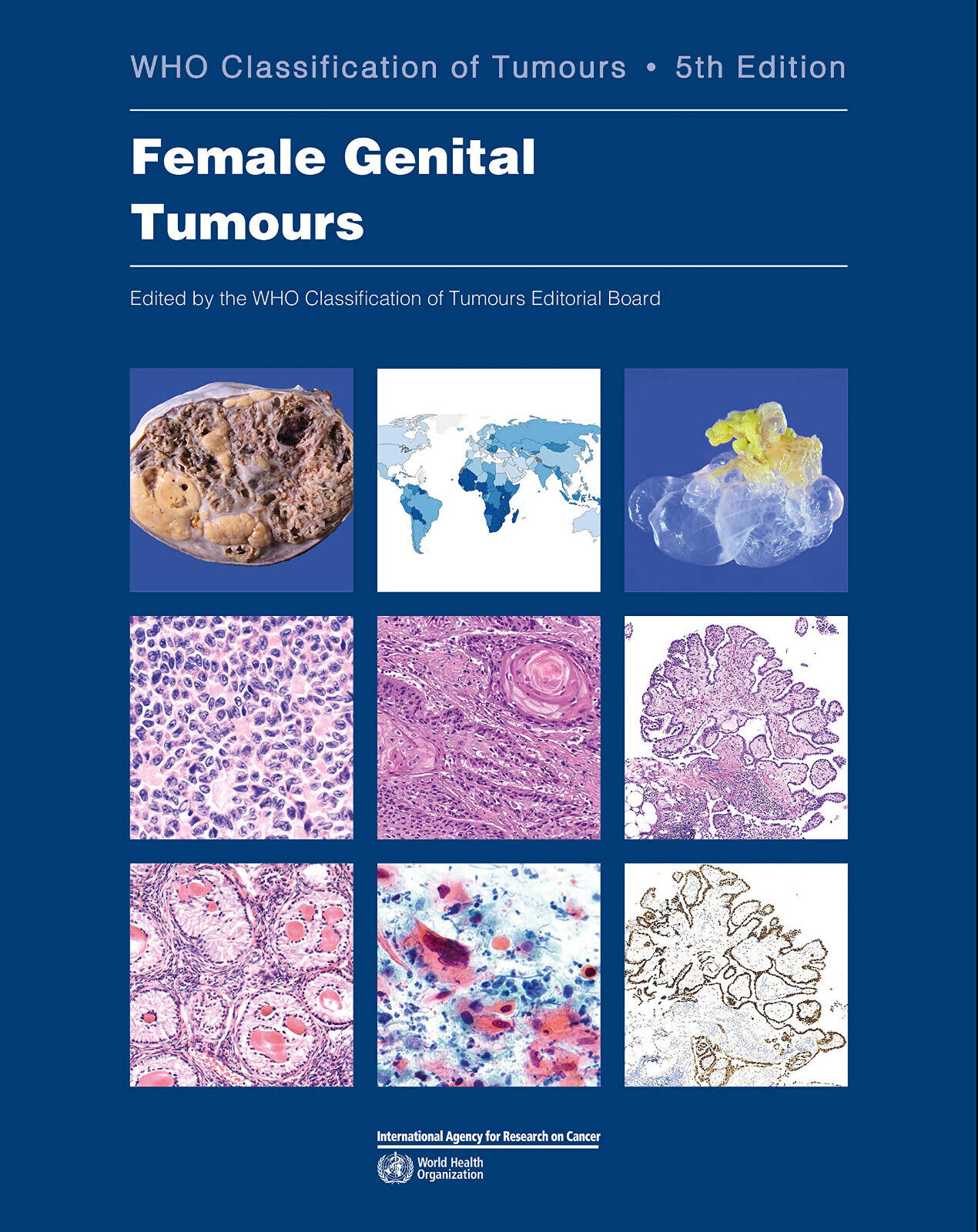 Female Genital Tumours - Who -  WORLD HEALTH ORGN, 2020