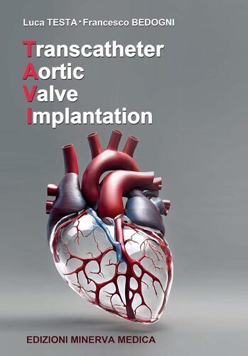 Transcatheter aortic valve implantation