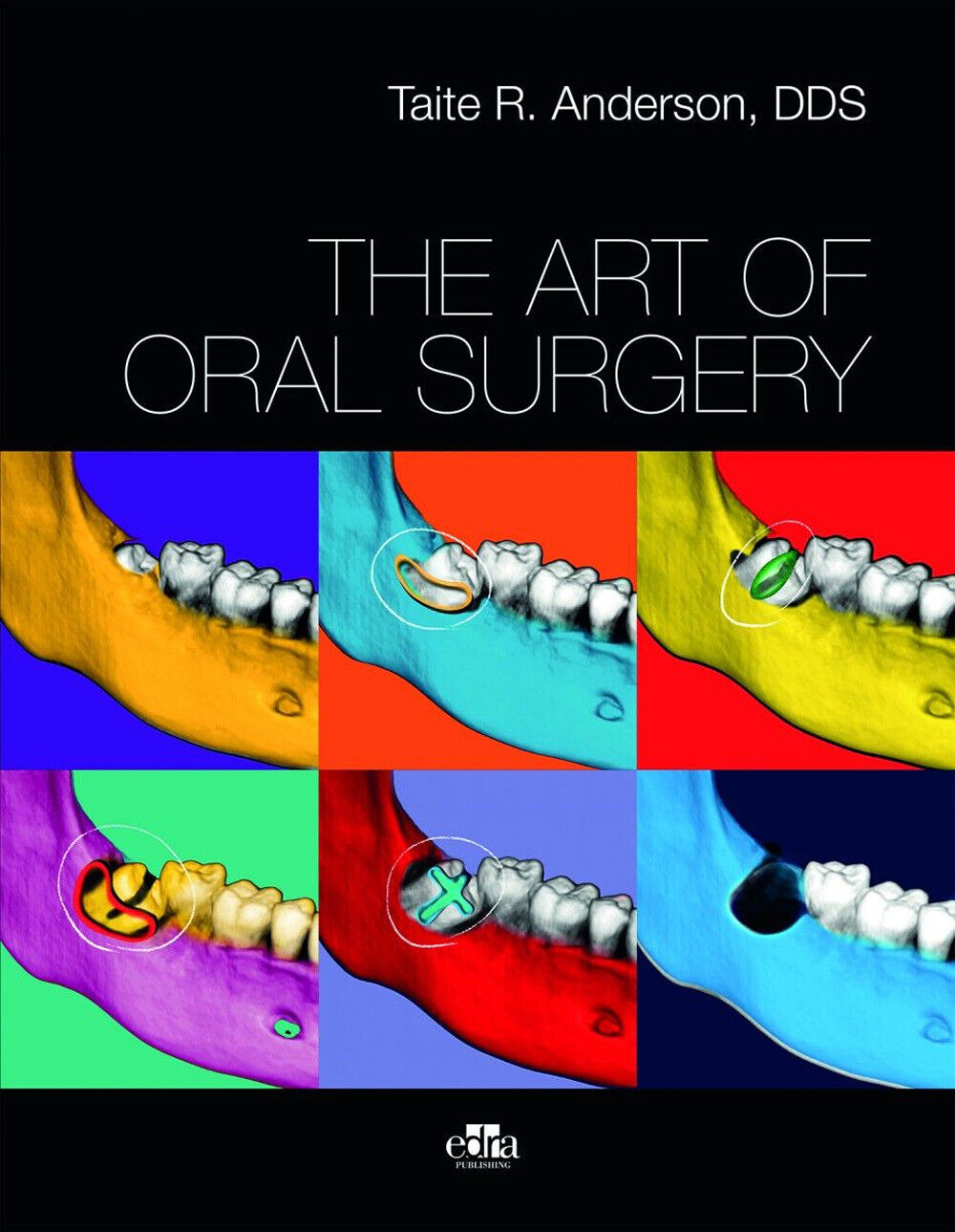 The art of oral surgery - Taite Anderson R.