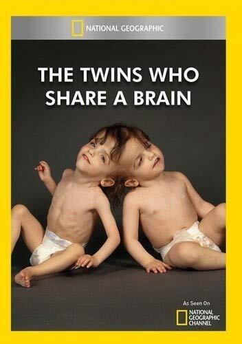 The Twins Who Share A Brain (DVD)