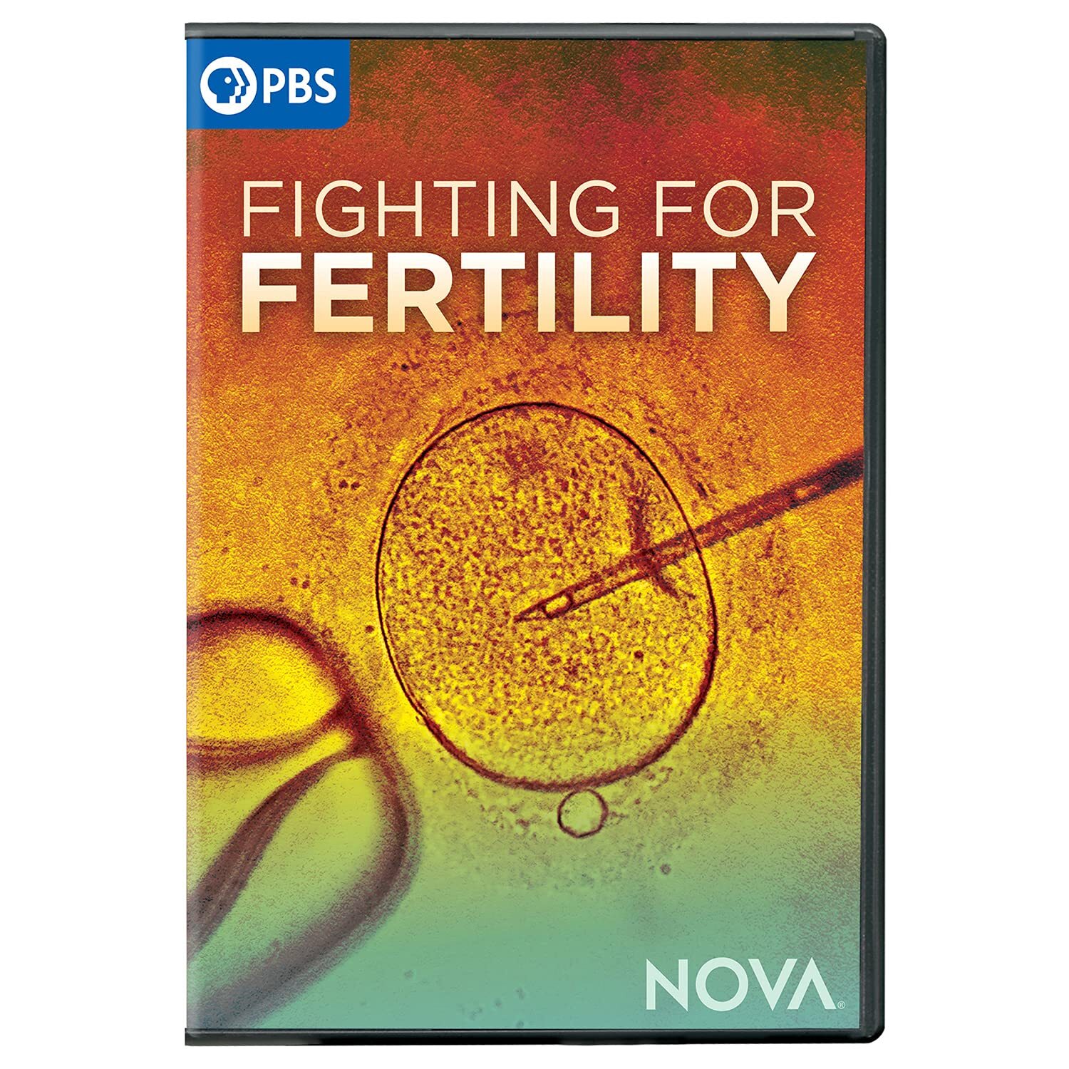 Nova: Fighting For Fertility (DVD)