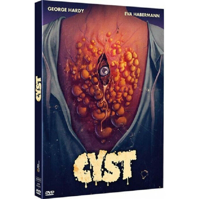 Cyst DVD Nuova