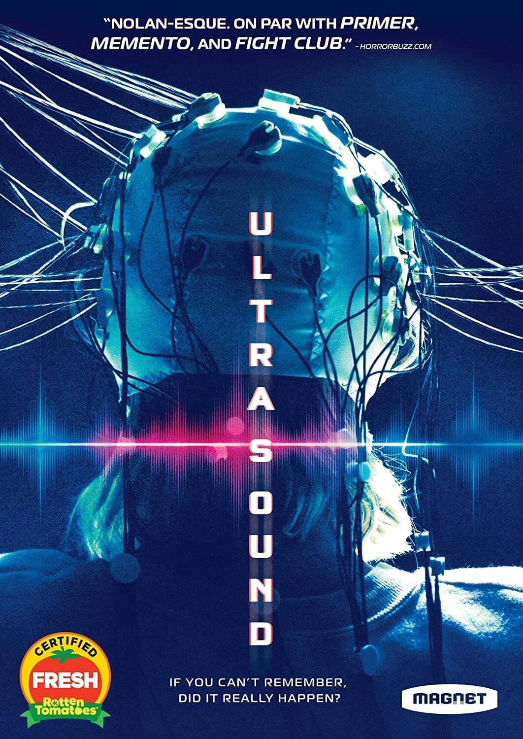 Ultrasound (DVD) Kartheiser Vincent Lopez Chelsea Wool Breeda