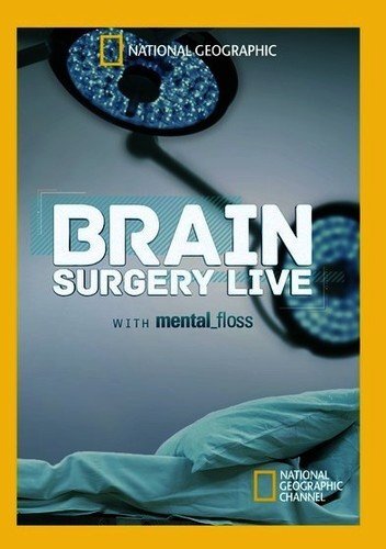 Brain Surgery Live with Mental Floss (DVD)