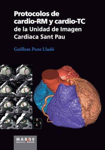 Protocolos De Cardio-Rm Y Cardio-Tc De La Unidad De Imagen Cardiaca Sant Pau