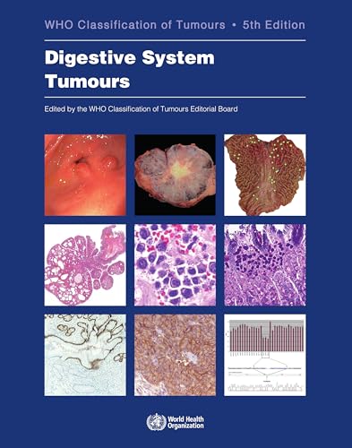 Digestive System Tumours: Who Classification Of Tumours, Volume 1