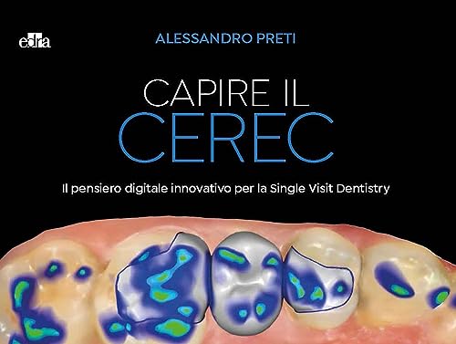 Capire Il Cerec. Il Pensiero Digitale Innovativo Per La Single Visit Dentistry