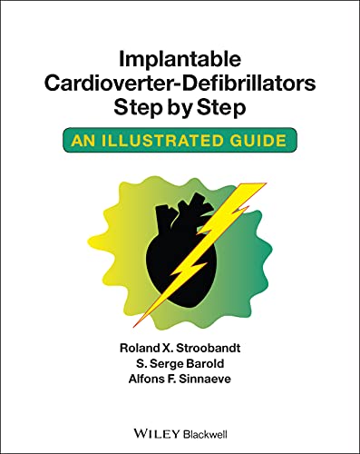Implantable Cardioverter-Defibrillators Step By Step: An Illustrated Guide
