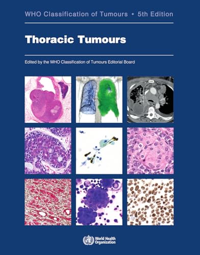 Thoracic Tumours: 5
