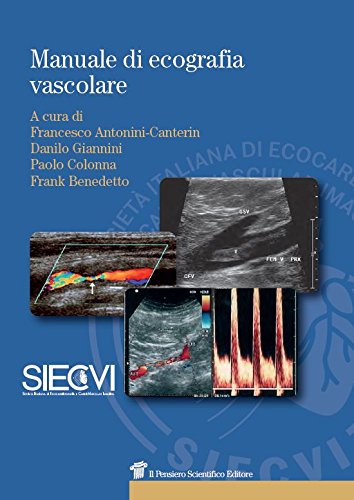 Manuale Di Ecografia Vascolare