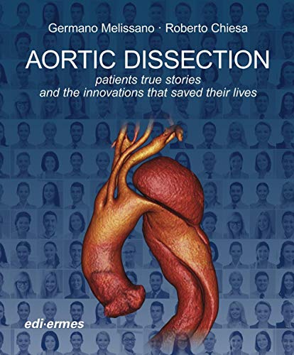 Aortic Dissection. Patients True Stories And The Innovations That Saved Their Lives
