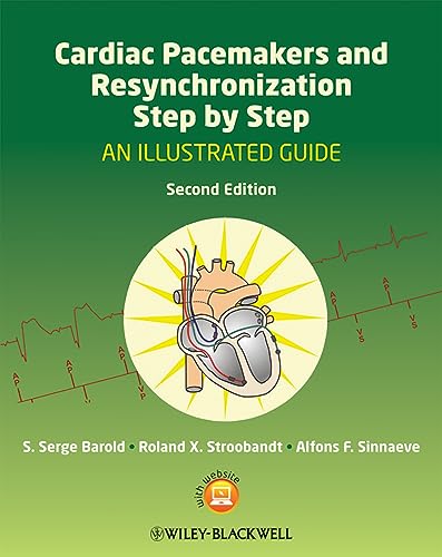Cardiac Pacemakers And Resynchronization Step By Step: An Illustrated Guide