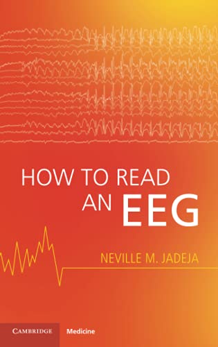 How To Read An Eeg