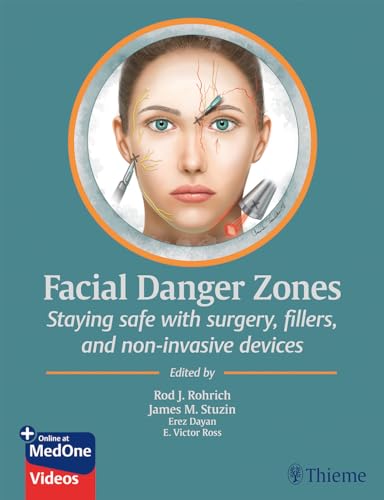 Facial Danger Zones
