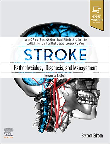 Stroke: Pathophysiology, Diagnosis, And Management