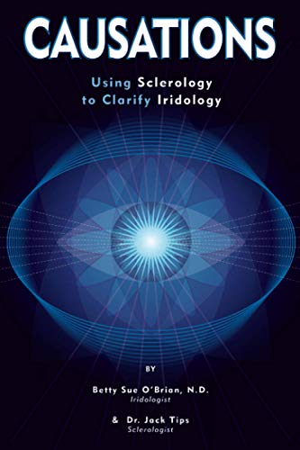 Causations: Using Sclerology To Clarify Iridology