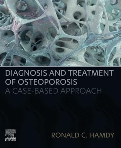 Diagnosis And Treatment Of Osteoporosis: A Case-Based Approach