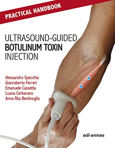 Practical Handbook For Ultrasound-Guided Botulinum Toxin Injection