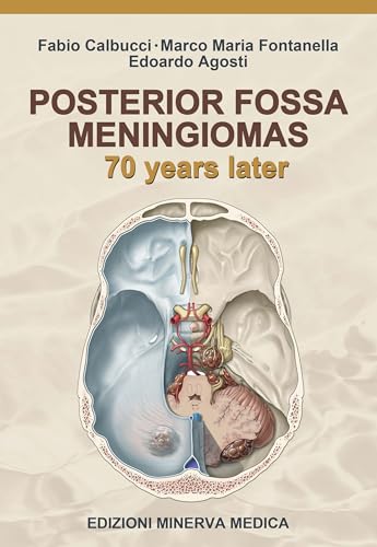 Posterior Fossa Meningiomas. 70 Years Later