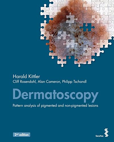 Dermatoscopy: An Algorithmic Method Based On Pattern Analysis