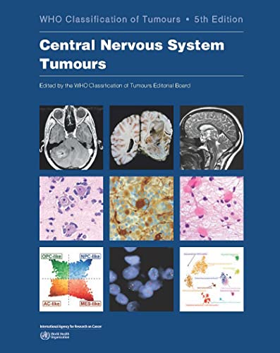 Central Nervous System Tumours: Who Classification Of Tumours