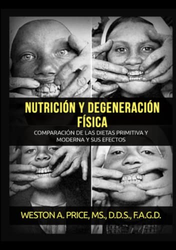 Nutrición Y Degeneración Física