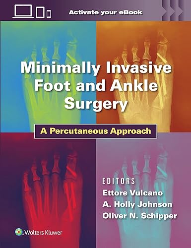 Minimally Invasive Foot And Ankle Surgery: A Percutaneous Approach