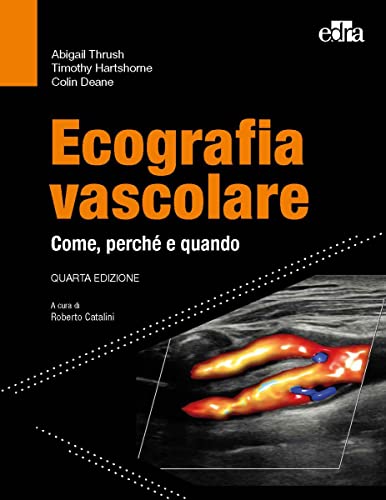 Ecografia Vascolare