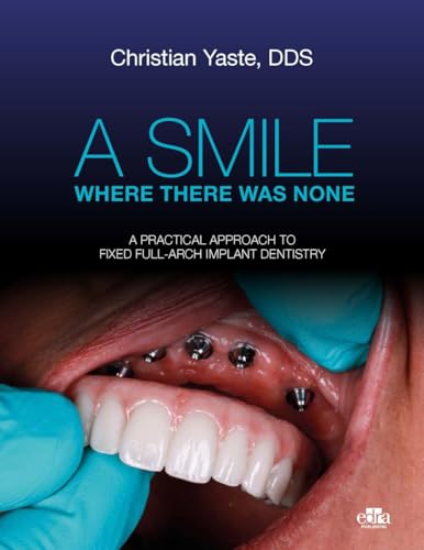 A Smile Where There Was None. A Pratical Approach To Fixed Full-Arch Implant Dentistry
