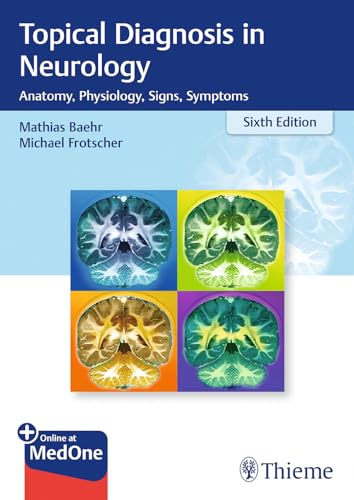 Topical Diagnosis In Neurology: Anatomy, Physiology, Signs, Symptoms
