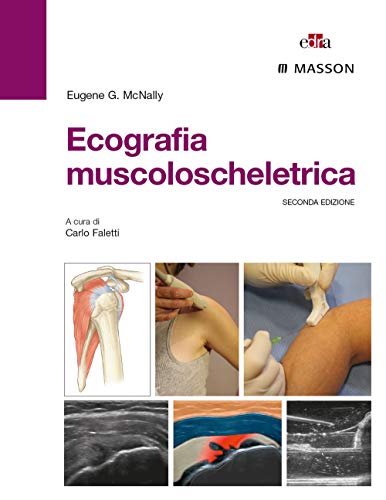 Ecografia Muscoloscheletrica. Ediz. Illustrata