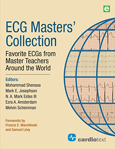 Ecg Masters Collection: Favorite Ecgs From Master Teachers Around The World