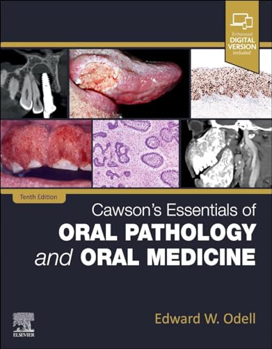 Cawson'S Essentials Of Oral Pathology And Oral Medicine