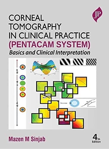 Corneal Tomography In Clinical Practice (Pentacam System): Basics And Clinical Interpretation
