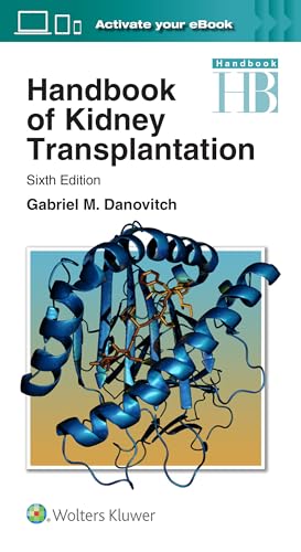 Handbook Of Kidney Transplantation