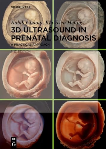 3D Ultrasound In Prenatal Diagnosis: A Practical Approach